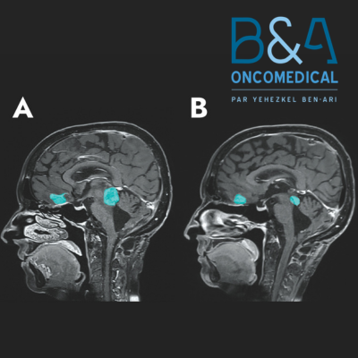 votredircom-agence-de-relation-presse-sante-neurosciences-b&aoncomedical-benari-