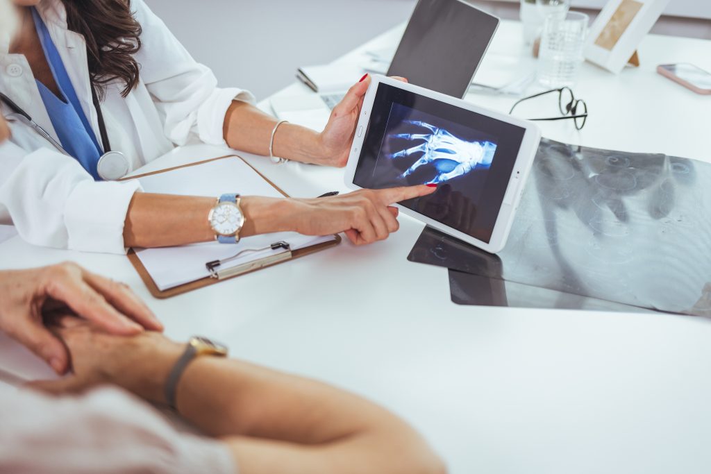 Doctor and patient looking at x-ray and hand in doctor’s office. Close-up of female hands holding skiagram. Serious surgeon looking attentively on wrist x-ray and making diagnosis. Fer à Cheval